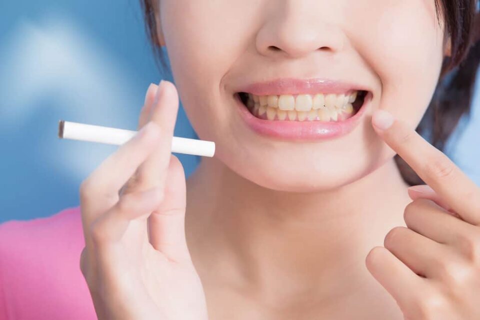 Smoker’s Teeth Tobacco and Oral Health Laserostop Luxembourg Laser Anti-Smoking Center Smoker's Teeth Tobacco and Oral Health Laserostop Luxembourg Laser Anti-Smoking Center